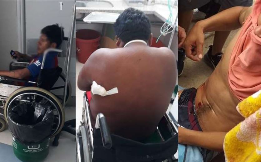 Al menos cinco heridos de bala en Santa Cruz, uno de ellos se encuentra en situación crítica