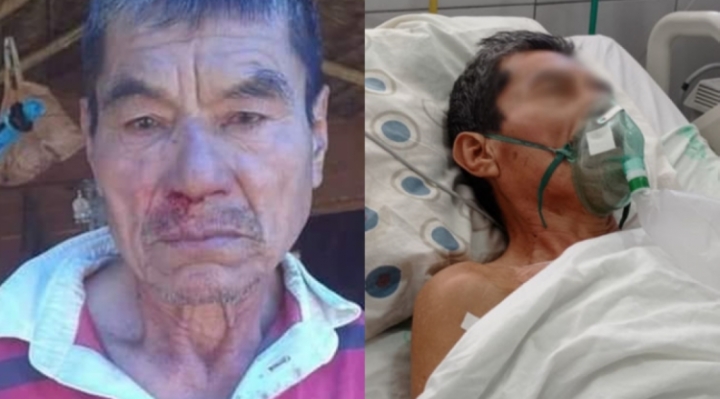 Fallece el indígena que resultó herido en una pugna por tierras en San Ignacio