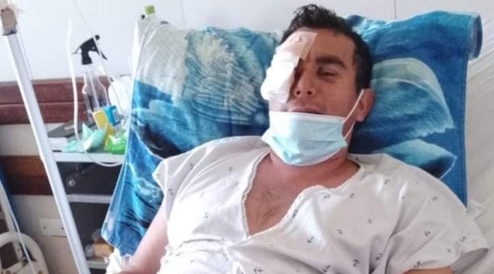 Fallece Erwin, el hombre que perdió el ojo durante una represión policial en Santa Cruz