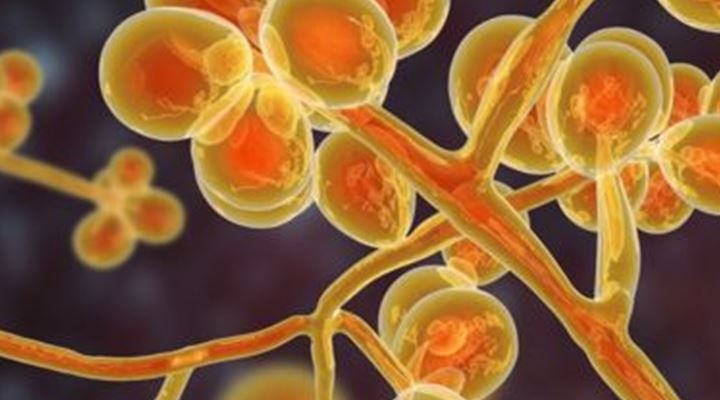 Candida auris: el mapa que muestra la peligrosa expansión de la ...