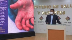 Bolivia registra 65 casos de viruela del mono, la mayoría está en Santa Cruz