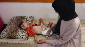 NNUU: Niños palestinos mueren de hambre frente a sus familias