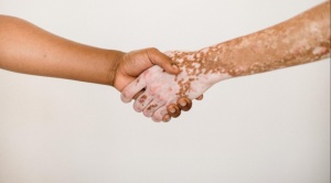 Recuerdan Día Mundial del Vitíligo, una enfermedad degenerativa de la piel 1