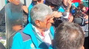 Alcalde Arias sufre un corte en la ceja derecha tras recibir una pedrada en la plaza Abaroa