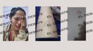 Periodista Entrambasaguas publica fotos donde aparece la exnovia de Evo golpeada 1