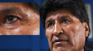 Evo se sometió a un delineado permanente de ojos, dice experta en maquillaje