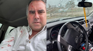 Candidato presidencial de Perú sobrevive a un atentado tras ser tiroteado en su vehículo